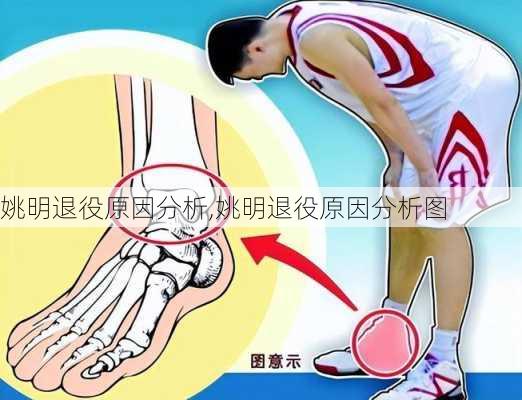 姚明退役原因分析,姚明退役原因分析图